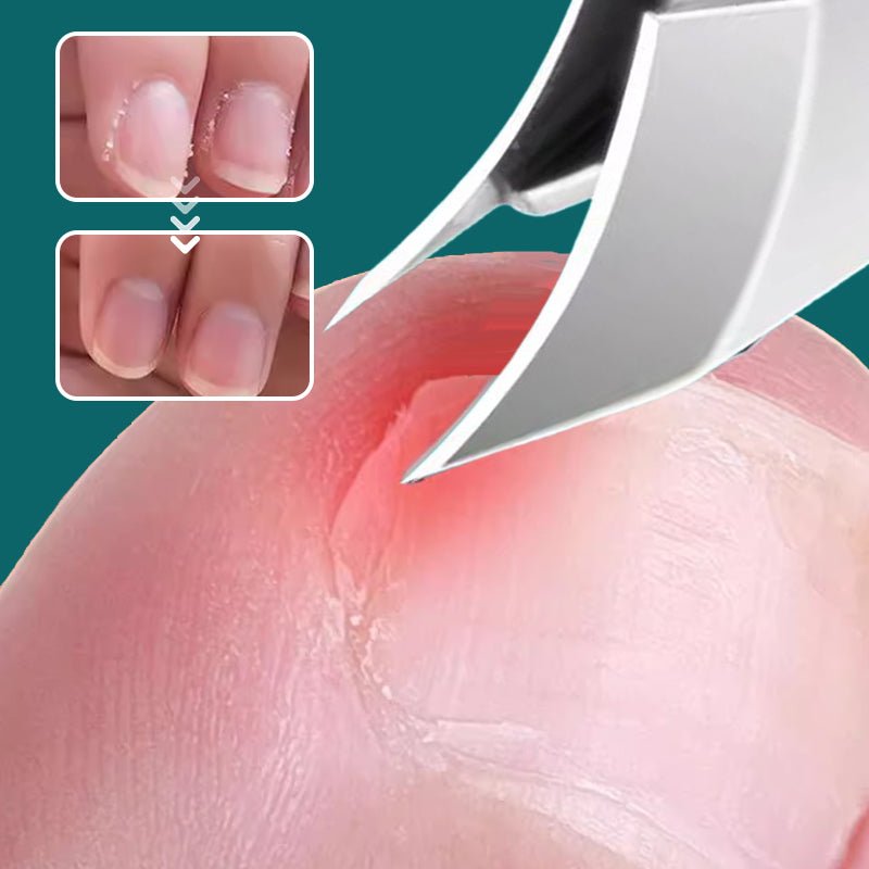 🔥2026 Hot Sale🔥 Anti-Splash 25° Slant Edge Nail Clipper 3-Piece Set - My Good Buys - 🔥2026 Hot Sale🔥 Anti-Splash 25° Slant Edge Nail Clipper 3-Piece Set