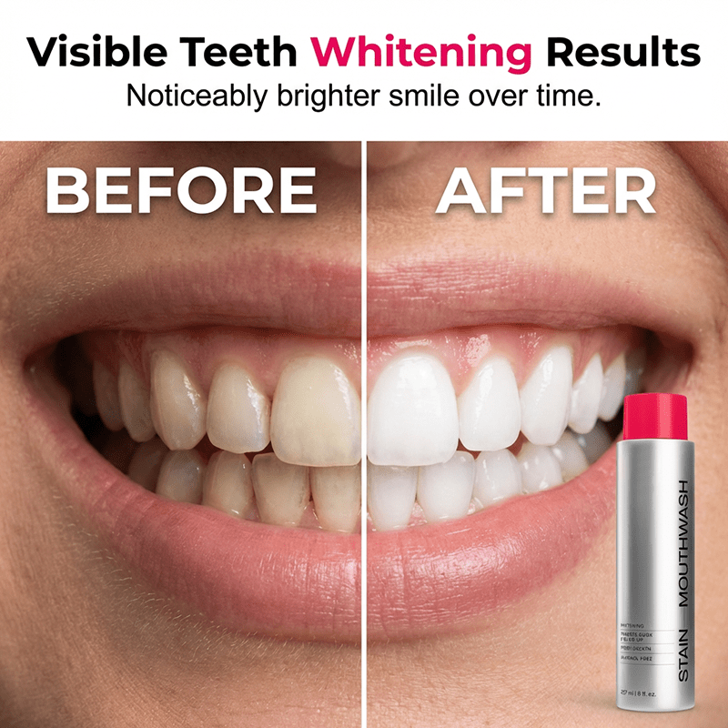🥳2026 HOT SALE🥳💞50K+ SOLD!😁✨ 50% OFF! Stain‑Removing Whitening Mouthwash – Lifts coffee & tea stains, alcohol‑free. Instant gunk binding, long‑lasting minty fresh. Gentle enough for daily use. 🦷💙 - My Good Buys - 🥳2026 HOT SALE🥳💞50K+ SOLD!😁✨ 50% OFF! Stain‑Removing Whitening Mouthwash – Lifts coffee & tea stains, alcohol‑free. Instant gunk binding, long‑lasting minty fresh. Gentle enough for daily use. 🦷💙