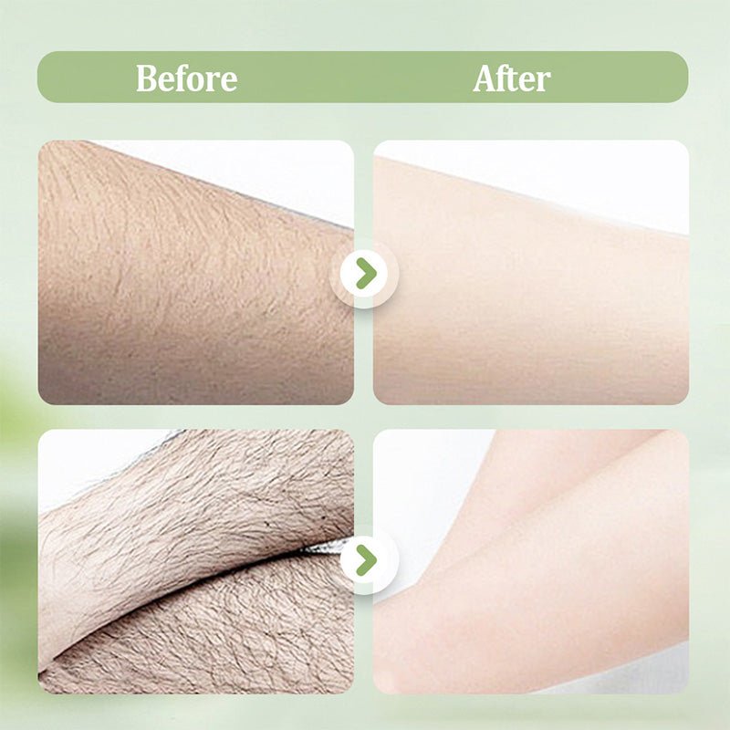 🏖️50% OFF⚡50K+ SOLD💕🎁Gentle and Non-Irritating Hair Removal Cream - My Good Buys - 🏖️50% OFF⚡50K+ SOLD💕🎁Gentle and Non-Irritating Hair Removal Cream