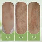 🏖️50% OFF⚡50K+ SOLD💕🎁Gentle and Non-Irritating Hair Removal Cream - My Good Buys - 🏖️50% OFF⚡50K+ SOLD💕🎁Gentle and Non-Irritating Hair Removal Cream