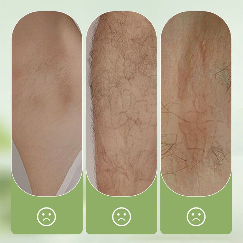 🏖️50% OFF⚡50K+ SOLD💕🎁Gentle and Non-Irritating Hair Removal Cream - My Good Buys - 🏖️50% OFF⚡50K+ SOLD💕🎁Gentle and Non-Irritating Hair Removal Cream