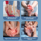Adjustable Hallux Valgus Bunion Corrector - My Good Buys - Adjustable Hallux Valgus Bunion Corrector
