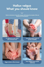 Adjustable Hallux Valgus Bunion Corrector - My Good Buys - Adjustable Hallux Valgus Bunion Corrector