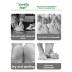 Antibacterial Foot Wash For Stinky Feet With 360° Brush - My Good Buys - Antibacterial Foot Wash For Stinky Feet With 360° Brush