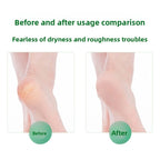 Antibacterial Foot Wash For Stinky Feet With 360° Brush - My Good Buys - Antibacterial Foot Wash For Stinky Feet With 360° Brush