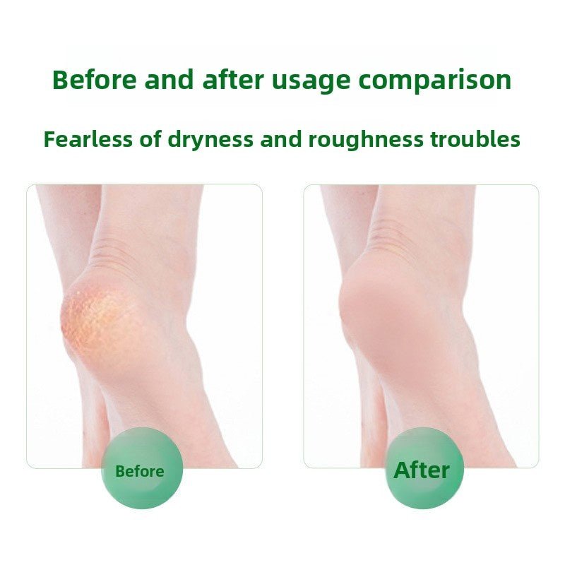 Antibacterial Foot Wash For Stinky Feet With 360° Brush - My Good Buys - Antibacterial Foot Wash For Stinky Feet With 360° Brush