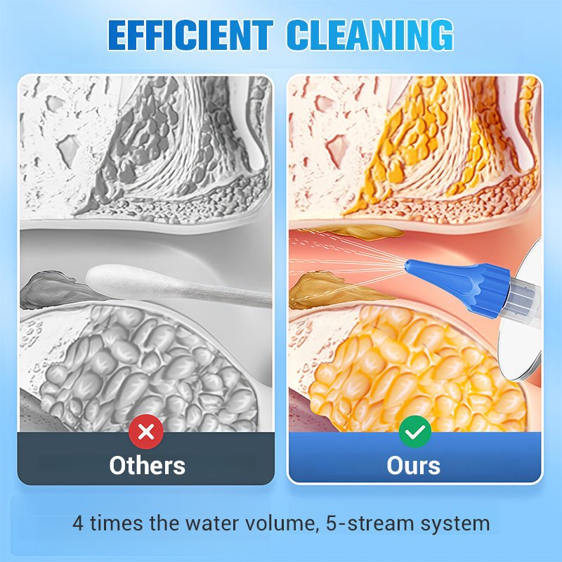 📢📢BIG SALE!!⏰👂 Ear Wax Removal Kit – Safe, Gentle & Reusable Silicone Spoon for Easy, Hygienic Ear Cleaning ✨🛡️ - My Good Buys - 📢📢BIG SALE!!⏰👂 Ear Wax Removal Kit – Safe, Gentle & Reusable Silicone Spoon for Easy, Hygienic Ear Cleaning ✨🛡️