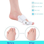 Bunion Corrector for Men and Women - My Good Buys - Bunion Corrector for Men and Women