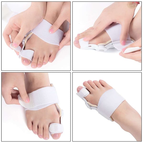 Bunion Corrector for Men and Women - My Good Buys - Bunion Corrector for Men and Women