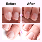 💜BUY 1 GET 1 FREE💜Repairing Nail Damage✨ "Fragrance + manicure + armor" in ONE portable nail care pen💅 - My Good Buys - 💜BUY 1 GET 1 FREE💜Repairing Nail Damage✨ "Fragrance + manicure + armor" in ONE portable nail care pen💅