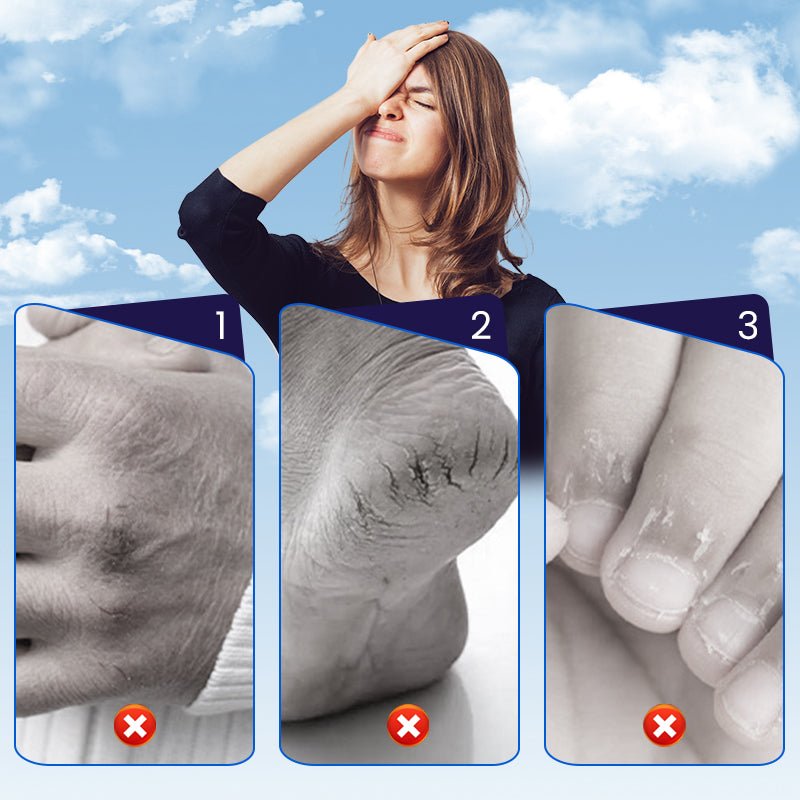 🩹 BUY 2 GET 1 FREE! ✨ Cracked Skin Repair Patch - Deep Hydration for Heels/Elbows, Pain Relief in 2 Hours, Invisible & Waterproof ⏳📦 - My Good Buys - 🩹 BUY 2 GET 1 FREE! ✨ Cracked Skin Repair Patch - Deep Hydration for Heels/Elbows, Pain Relief in 2 Hours, Invisible & Waterproof ⏳📦