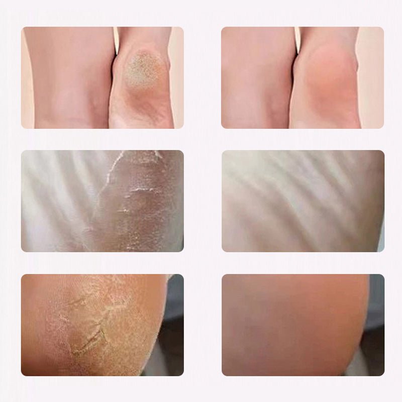 Electric Foot Scrubber for Smooth Healthy Skin - My Good Buys - Electric Foot Scrubber for Smooth Healthy Skin