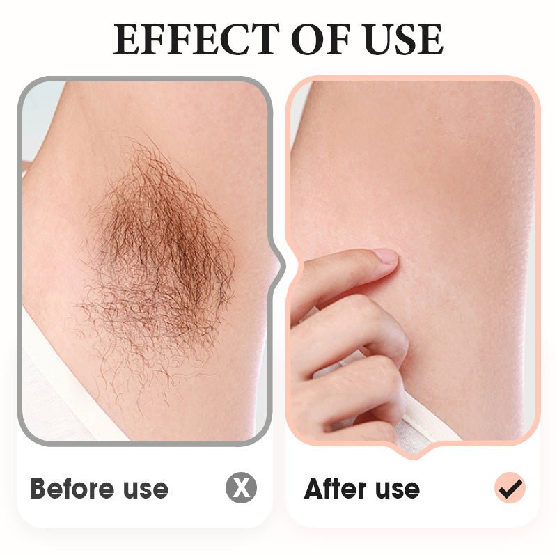 ✨Gentle Hair Removal Cream for Underarms, Legs, and Arms - My Good Buys - ✨Gentle Hair Removal Cream for Underarms, Legs, and Arms