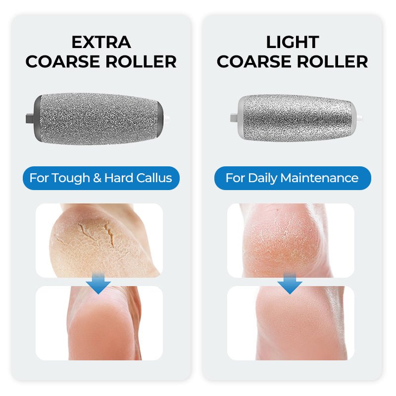 🔥Hot Sale - 50% OFF🔥Electric Feet Callus Remover⚡ - My Good Buys - 🔥Hot Sale - 50% OFF🔥Electric Feet Callus Remover⚡