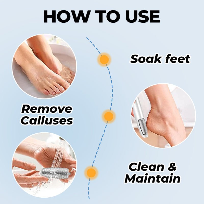 🔥Hot Sale - 50% OFF🔥Electric Feet Callus Remover⚡ - My Good Buys - 🔥Hot Sale - 50% OFF🔥Electric Feet Callus Remover⚡