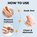 🔥Hot Sale - 50% OFF🔥Electric Feet Callus Remover⚡ - My Good Buys - 🔥Hot Sale - 50% OFF🔥Electric Feet Callus Remover⚡