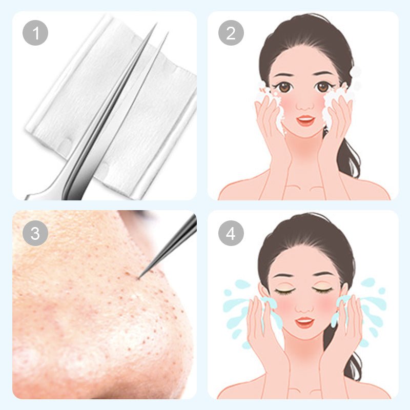 💓HOT SALE 50% OFF💥Stainless Steel Blackhead Removal Kit (with free alcohol pads) - My Good Buys - 💓HOT SALE 50% OFF💥Stainless Steel Blackhead Removal Kit (with free alcohol pads)
