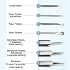 💓HOT SALE 50% OFF💥Stainless Steel Blackhead Removal Kit (with free alcohol pads) - My Good Buys - 💓HOT SALE 50% OFF💥Stainless Steel Blackhead Removal Kit (with free alcohol pads)