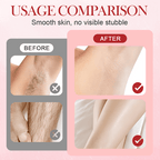 🔥Hot Sale Deals-Portable Dual-Head Electric Epilator - My Good Buys - 🔥Hot Sale Deals-Portable Dual-Head Electric Epilator