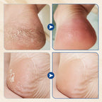 Hydrating and Anti-Cracking Foot Cream - My Good Buys - Hydrating and Anti-Cracking Foot Cream