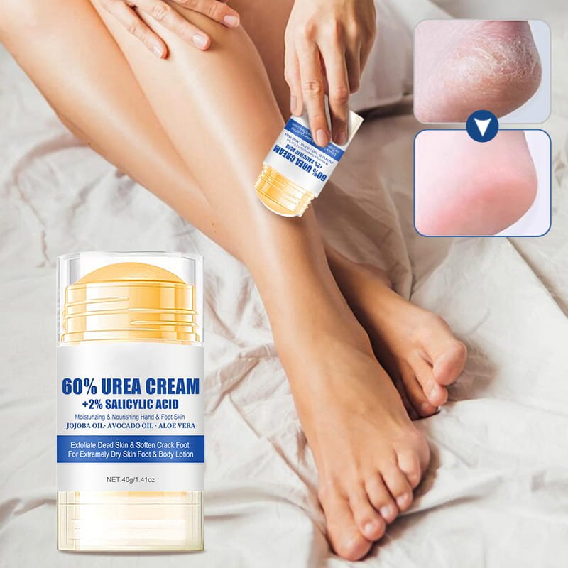 Hydrating and Anti-Cracking Foot Cream - My Good Buys - Hydrating and Anti-Cracking Foot Cream