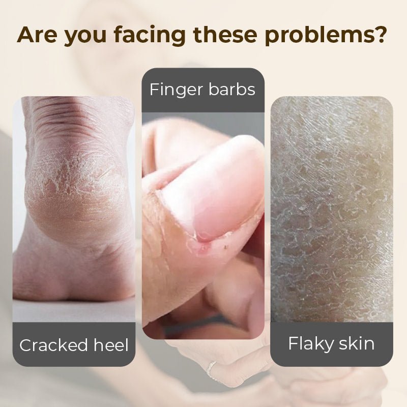 Hydrating and Anti-Cracking Foot Cream - My Good Buys - Hydrating and Anti-Cracking Foot Cream