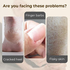 Hydrating and Anti-Cracking Foot Cream - My Good Buys - Hydrating and Anti-Cracking Foot Cream