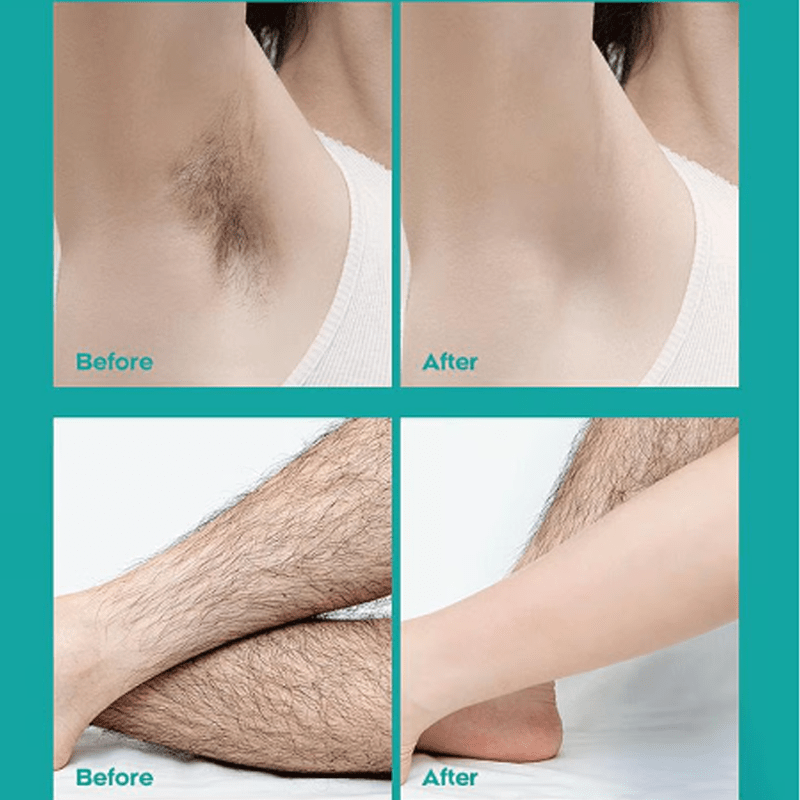 🔥Painless Full Body Hair Removal Cream for Men & Women– Skin-friendly for all areas🌿 - My Good Buys - 🔥Painless Full Body Hair Removal Cream for Men & Women– Skin-friendly for all areas🌿