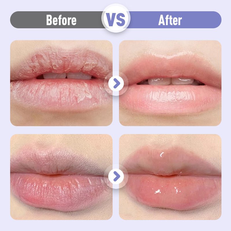 Plumping & Anti-Wrinkle Hydrating Lip Serum - My Good Buys - Plumping & Anti-Wrinkle Hydrating Lip Serum