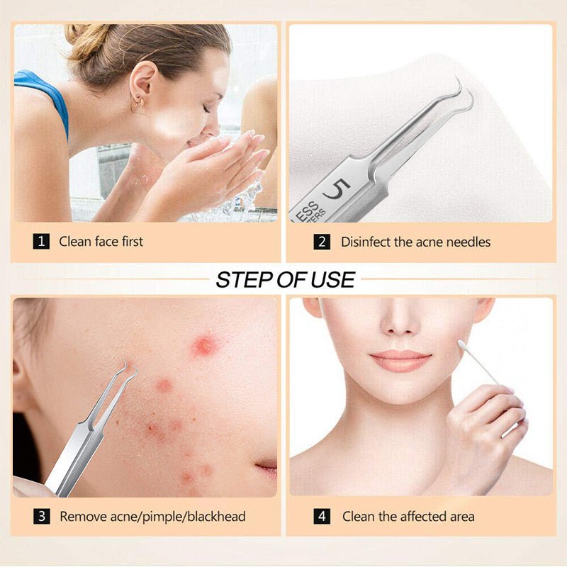 Specialised tweezers for beauty salo - My Good Buys - Specialised tweezers for beauty salo
