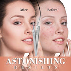 Specialised tweezers for beauty salo - My Good Buys - Specialised tweezers for beauty salo