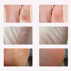 Electric Foot Scrubber for Smooth Healthy Skin