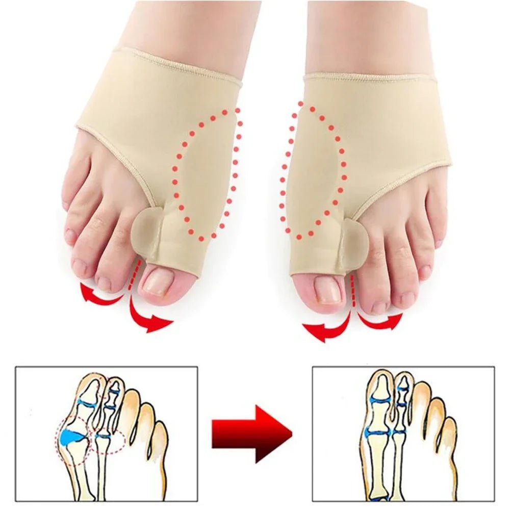 Toe Valgus Corrective Socks - My Good Buys - Toe Valgus Corrective Socks