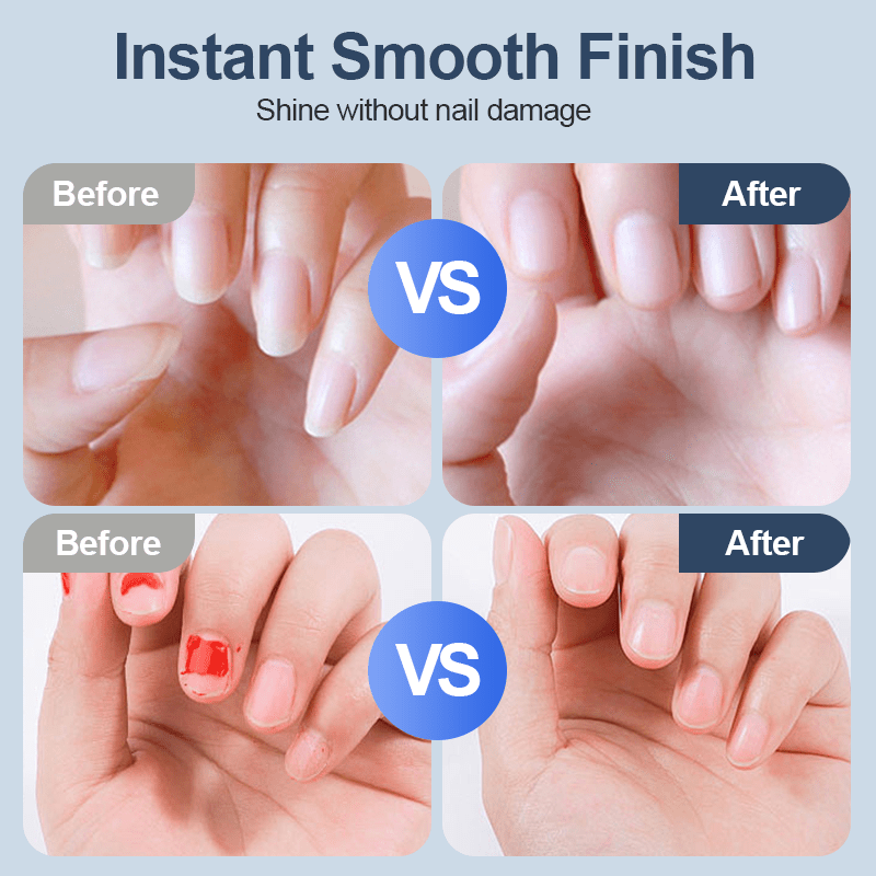 Universal Automatic Fingernail Grinder for Adults and Children - My Good Buys - Universal Automatic Fingernail Grinder for Adults and Children